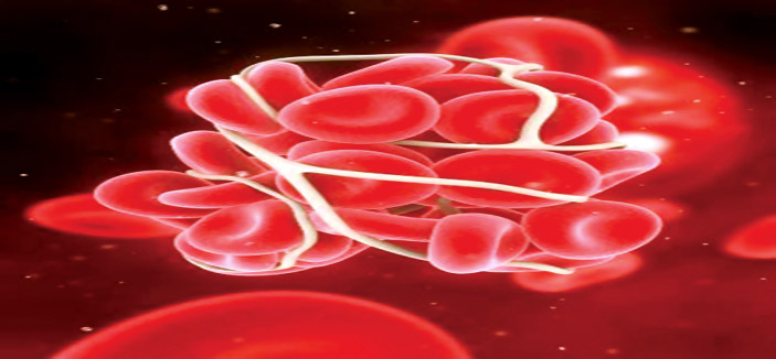عقار جديد يطيل فترة مقاومة مرضى سرطان الدم 