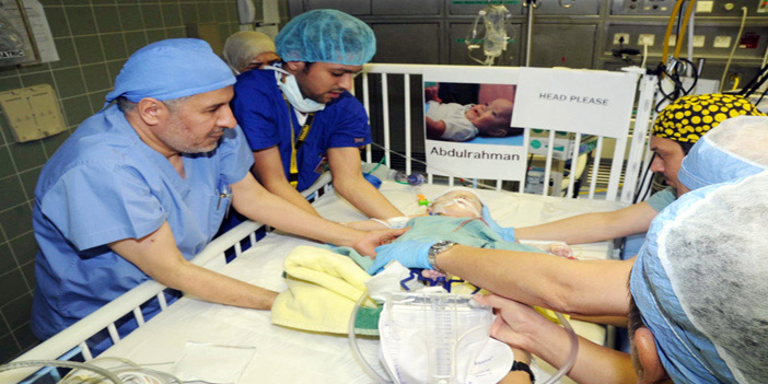 الفريق الطبي والجراحي يعلن نجاح عملية فصل التوأم السيامي اليمني 
