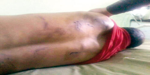   أحد شباب تعز تعذبه ميليشيا الحوثي حتى الموت