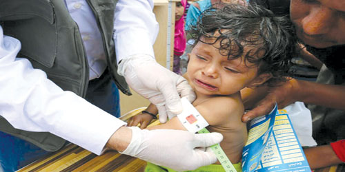 مركز الملك سلمان للإغاثة يقف ميدانيًا على مشروع علاج سوء التغذية في لحج 