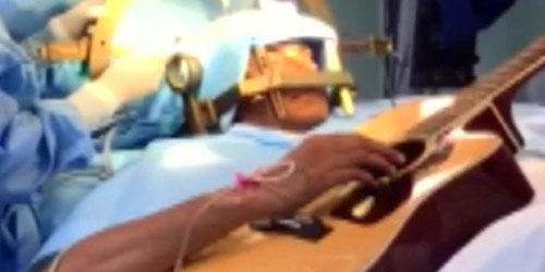 موسيقي هندي يعزف على الجيتار أثناء خضوعه لعملية جراحية في الدماغ 