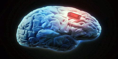 جهاز إلكتروني جديد يزرع في المخ من أجل تنشيط الذاكرة! 