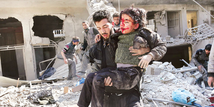  طفل سوري مصاب بجروح خطيرة تم إخراجه من بين ركام الدمار في الغوطة