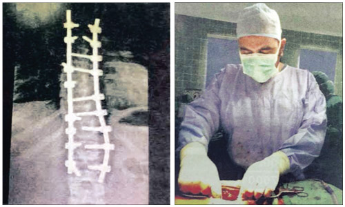  الدكتور حازم فريد جراح العمود الفقري وصورة توضح الاعوجاج