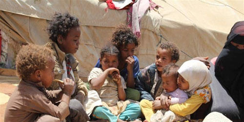 الأمم المتحدة: أكثر من 113 مليون شخص يعانون من «جوع حاد» 