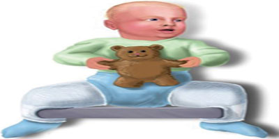 الخلع الولادي... في تطور وتقدم ملحوظ بين أطباء جراحة عظام الأطفال 