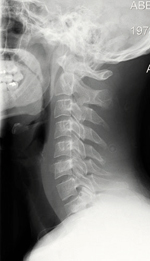 آلام الرقبة شائعة لدى الكثير من الأشخاص وتتطلب مراجعة الطبيب واتباع التعليمات
