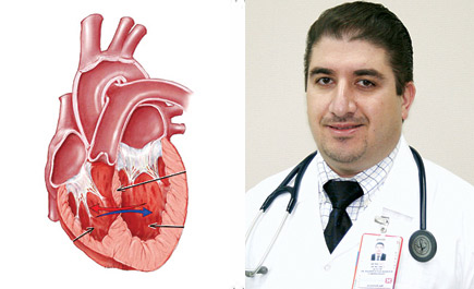 ثقب الحاجز القلبي عيب خلقي يمكن معالجته إذا اكتشف مبكراً 