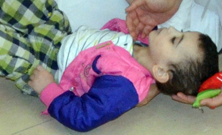 الدكتور بنجر يسعف طفلاً أثناء افتتاحه معرض صحة الفم والأسنان 