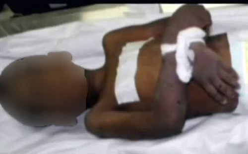 الوقداني: الطب الشرعي استقبل طفلا متوفيا نتيجة التعذيب على يد متبنيه 