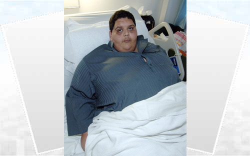 نجاح عملية شاب عشريني يعاني من السمنة المفرطة بطبية الملك فهد