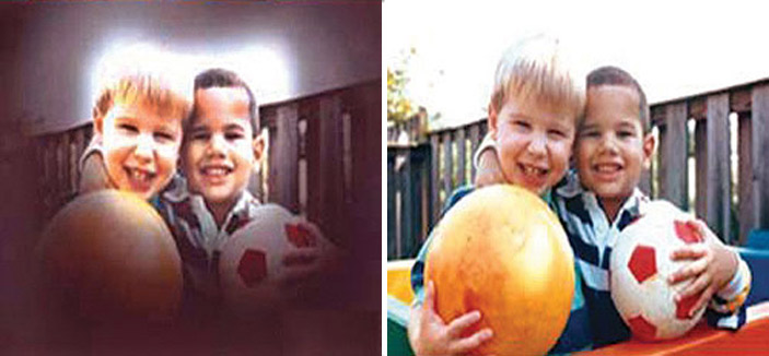 اعتلال الشبكية السكري أحد أهم أسباب الانفصال الشبكي للعين 