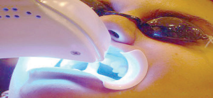 علماء يستخدمون الليزر لإعادة نمو الأسنان 