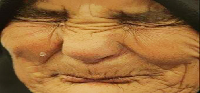 (الجحود) إنكار الشيء الظاهر مع العلم به 