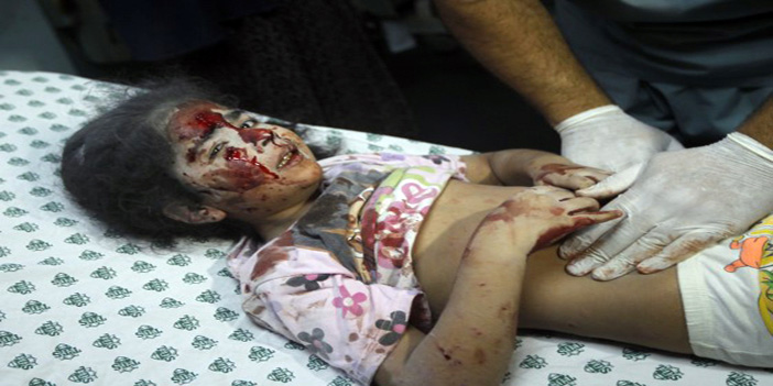  طفلة من ضحايا جرائم الاحتلال الصهيوني تتلقى العلاج المكثف