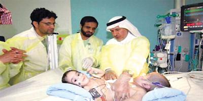 إجراء عملية فصل السيامي اليمني غداً بمستشفى الملك عبدالله للأطفال 
