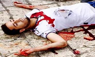 استشهاد شاب فلسطيني طعن جندياً إسرائيلياً في القدس 
