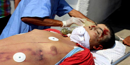  آلاف الجرحى الفلسطينيين خلال شهر أكتوبر