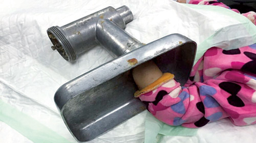 الدفاع المدني يحرر يد طفلة احتجزت داخل فرامة لحم 