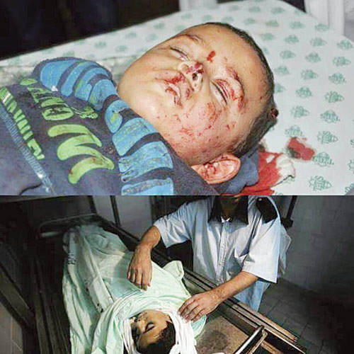  الطفل الفلسطيني الذي استشهد جراء قصف الاحتلال