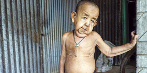 طفل عجوز في الرابعة من عمره 