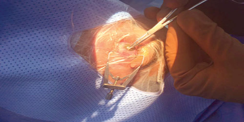  جانب من العملية