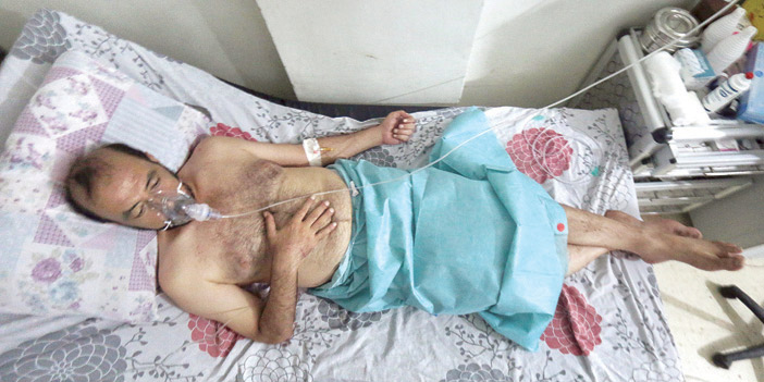  أحد السوريين يتلقى العلاج جراء إلقاء قوات النظام الغازات السامة على حلب