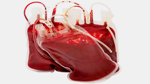 متى تكون معرفة فصيلة الدم مفيدة؟ 