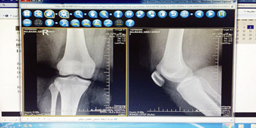  تفعيل نظام أرشفة ونقل صور الأشعة إلكترونيًا