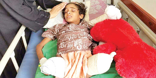مركز الملك سلمان للإغاثة يبادر بعلاج طفل يمني بترت رجلاه ويده 