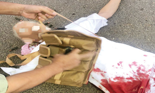  المواطن فواز الحربي بعد إصابته والقبض عليه