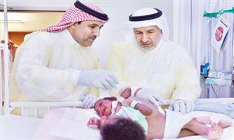 عملية فصل التوأم السيامي التنزاني «أنيشيا وملينيز» الأحد المقبل 