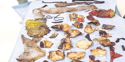 استخراج 30 قطعة بلاستيكية من بطن شاب 