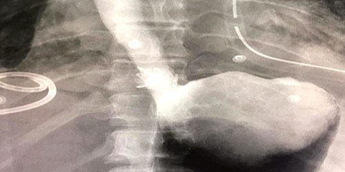  العملية الجراحية