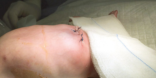  الطفل بعد العملية