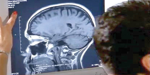 دودة ضخمة تقطن في رأس صيني 30 عامًا 