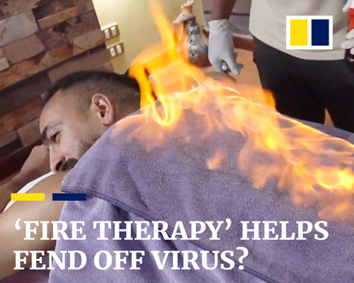  محمد طلعت مهاجم سموحة يتلقى العلاج بـ«الفوطة النارية»