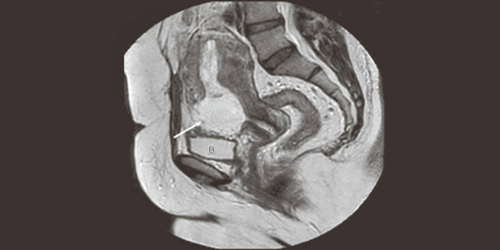  صورة أشعة للحمل خارج الرحم