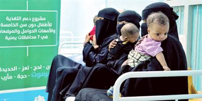 مركز الملك سلمان يواصل مشروع دعم التغذية للأطفال في اليمن 