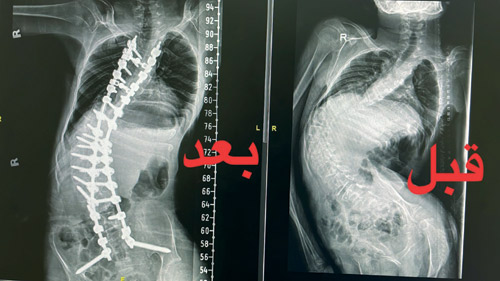 في مدينة الملك فهد الطبية 