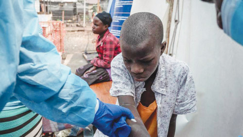 أوغندا تعلن تسجيل إصابتين بجدري القردة 