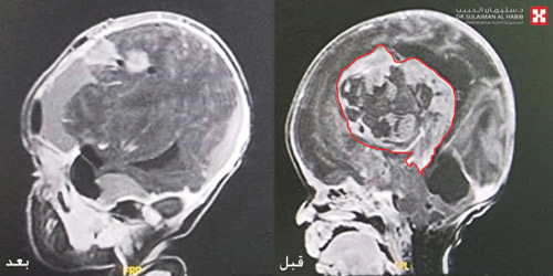 عمرها 14 يومًا.. وفي حالة نادرة على مستوى العالم 