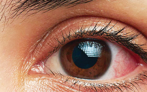 الاستعداد لإطلاق أول مهمة بحثية سعودية لدراسة ميكروبيوم العين في الفضاء 