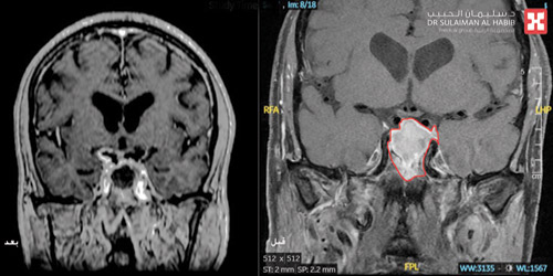 سبَّب له قصوراً شديداً في الوعي 