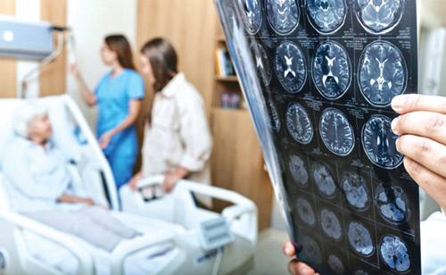 مرضى السكتات الدماغية قد لا يحتاجون مستقبلًا للتدخلات الجراحية 