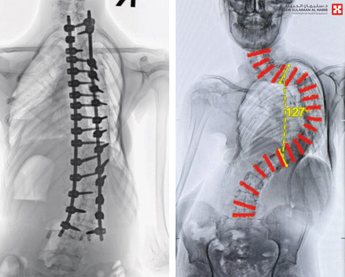 بدأت معاناتها بعد حادث مروري 