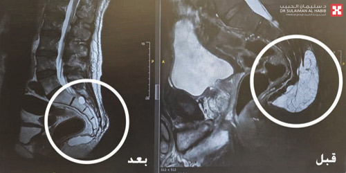 لمريض من جنوب إفريقيا وعانى منه لسنوات 