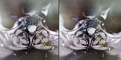 مجمع الدكتور سليمان الحبيب الطبي بالعليا يعيد الحركة لـ«ستينية» 