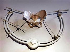 استشاري سعودي يحصل على براءة اختراع لجهاز إنقاذ إصابات الحوض 