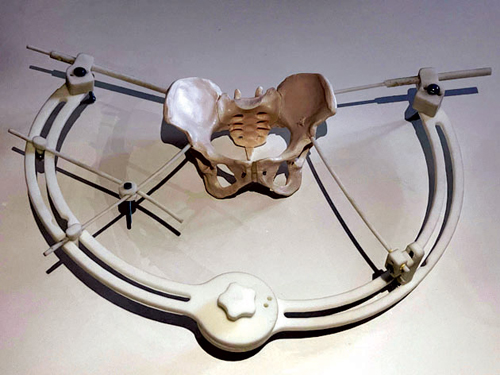 استشاري سعودي يحصل على براءة اختراع لجهاز إنقاذ إصابات الحوض 